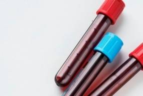 Тест на антитіла до бета-клітин підшлункової залози та інсуліну: показання для проведення та аналіз результатів