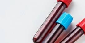Тест на антитіла до бета-клітин підшлункової залози та інсуліну: показання для проведення та аналіз результатів