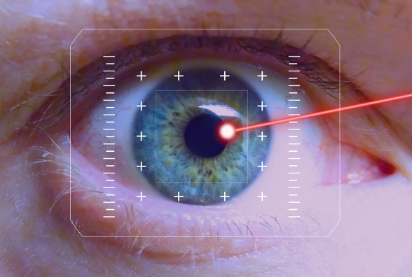 Лазерная коагуляция глаза при диабете thumbnail