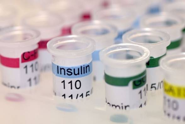 Аналіз на інсулін: Що означає занадто високий або низький рівень інсуліну в крові? - изображение