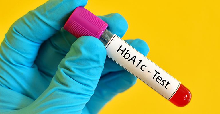 Как снизить показатель гликированного гемоглобина (HbA1c). Топ-5 советов - изображение